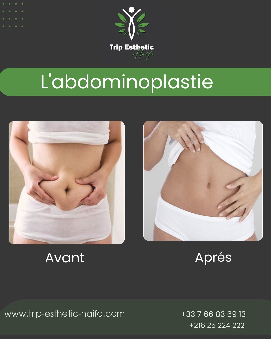 Abdominoplastie en Tunisie