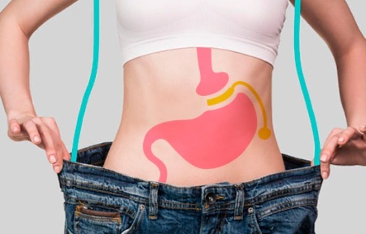 Schéma de l'anneau gastrique en Tunisie chez Trip Esthetic Haïfa