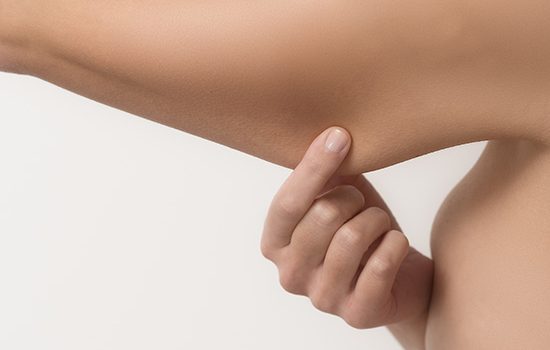Lifting des bras en Tunisie chez Trip Esthetic Haïfa