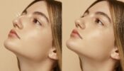 Rhinoplastie ultrasonique